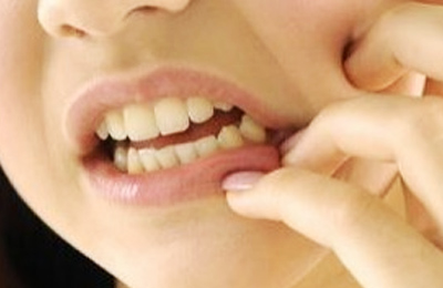 突發(fā)性、自發(fā)性的劇烈牙疼