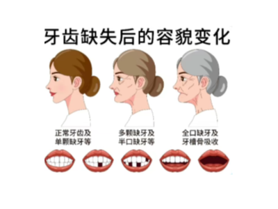 【科學科普】十個常用的口腔小知識！