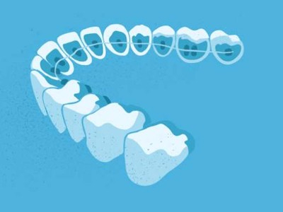 惟德口腔醫(yī)院口腔正畸好不好？